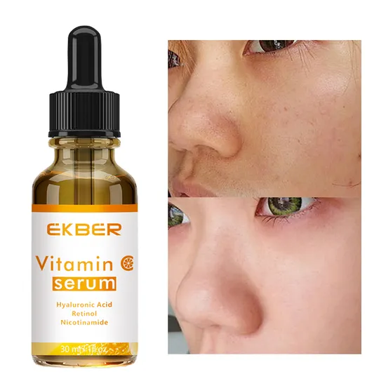 Organic Deep Moisturizing Anti Aging Skin Care Vitamin C Retinol Hyaluronic Acid Face Serum